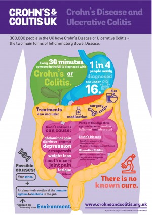 crohns and colitis infographic